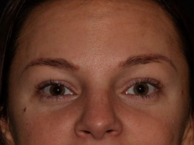 Close-up of a woman's face focusing on her eyes and nose, showing natural skin texture and no visible makeup.