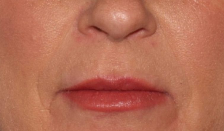 A close-up image of a person's lips and lower nose area, showing smooth skin and red lips with no distinct expression.