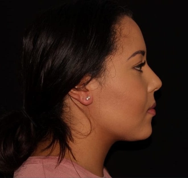 Side profile of a woman with dark hair pulled back, wearing a pink top and small earrings, against a dark background.