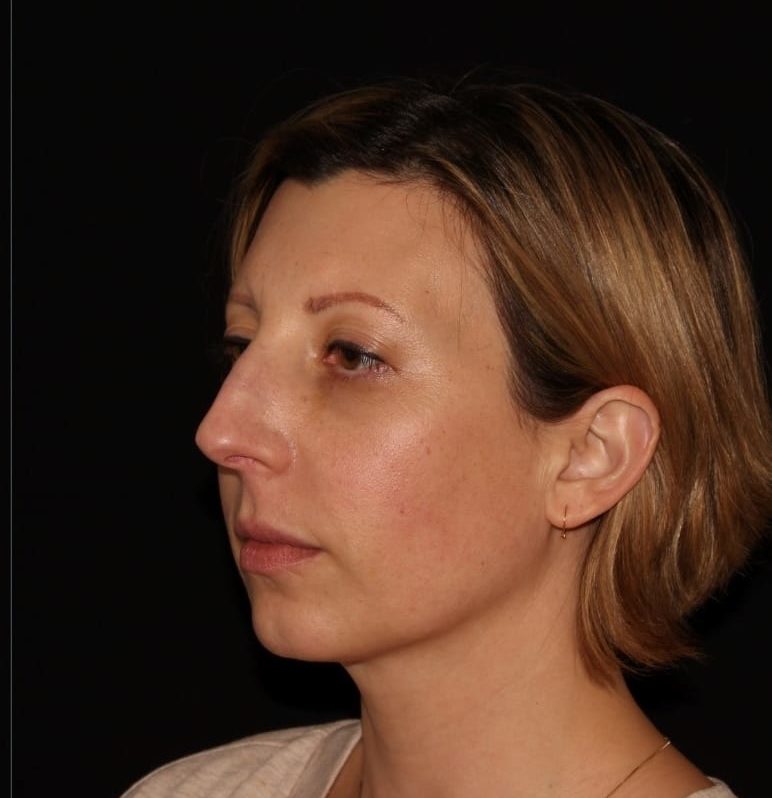 Profile view of a woman with short hair against a black background, looking to the left with a neutral expression.