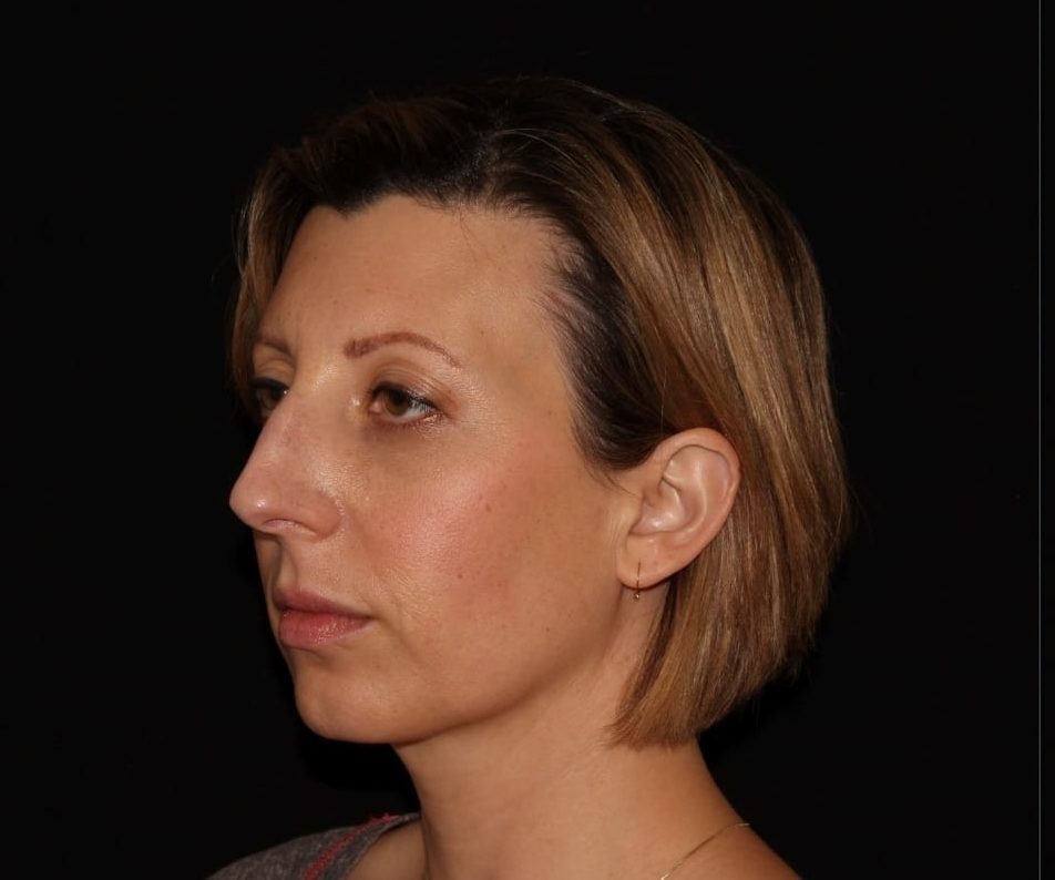 A side profile of a woman with short, brown hair against a black background. she appears calm and has a neutral expression.