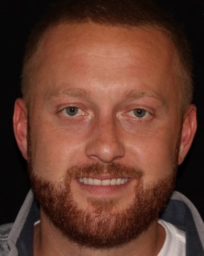 Close-up portrait of a smiling man with light brown hair and beard, wearing a gray shirt against a black background. his eyes are hazel, and he has a friendly expression.