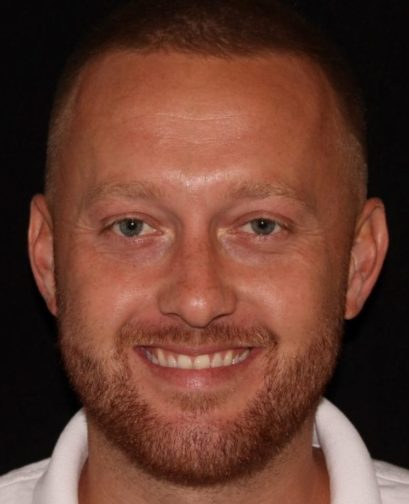 Portrait of a smiling man with a buzz cut and light stubble against a black background. he wears a white collared shirt.