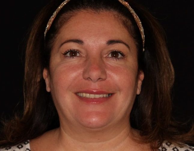 A smiling woman with medium-length brown hair wearing a headband, set against a dark background. she has light skin and is wearing minimal makeup.