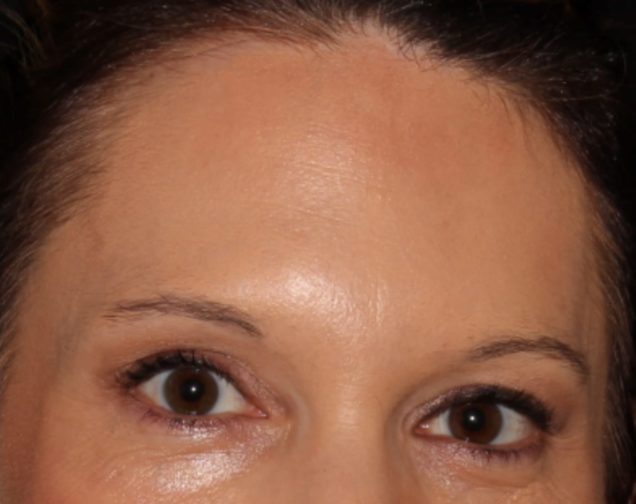 Close-up of a woman's face focusing on her eyes, which are brown and wide open, with visible eyebrows and part of her forehead. the background is indistinct.