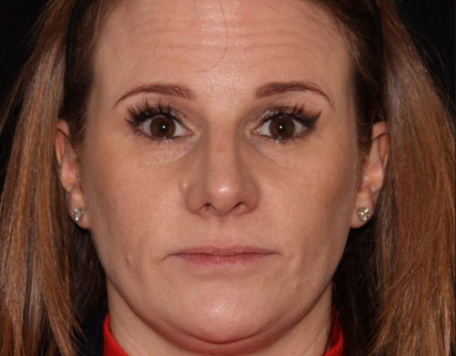 Close-up of a woman with fair skin, looking directly at the camera. she has long lashes, wears minimal makeup, and small earrings, with a neutral expression.