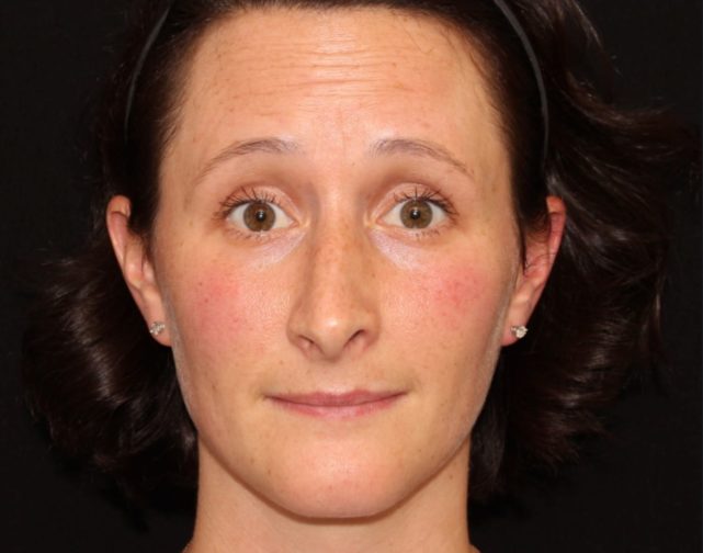 A close-up portrait of a woman with short curly hair, wearing small earrings and a headband, looking directly at the camera with a slight expression of surprise or curiosity.