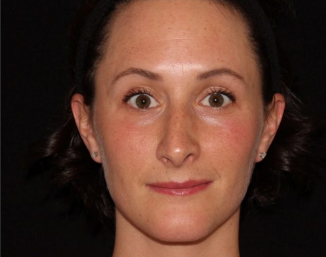 Close-up portrait of a woman with a neutral expression, wearing a black headband, and small earrings; she has light brown hair and clear skin.