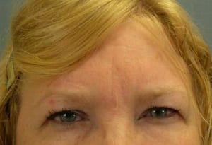 Close-up of a woman's eyes gazing into the camera, featuring her blonde hair and visible freckles, with a neutral expression.