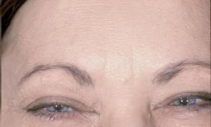 Close-up view of a woman's eyes, showing aged skin with wrinkles and crow's feet, eyebrows slightly raised, and a subtle hint of blue eyeshadow.