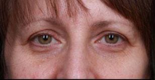 Close-up of a woman's eyes looking directly at the camera, featuring brown eyes, light skin, and a fringe of brown hair.