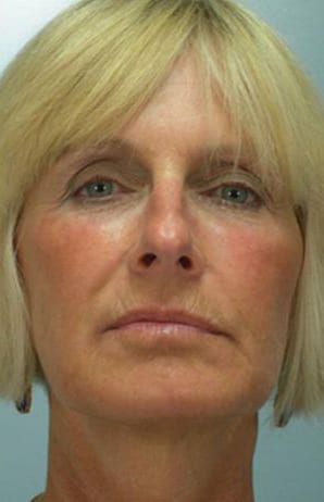 Close-up portrait of a middle-aged woman with short blonde hair, stern expression, looking directly at the camera. she has fair skin and light-colored eyes.