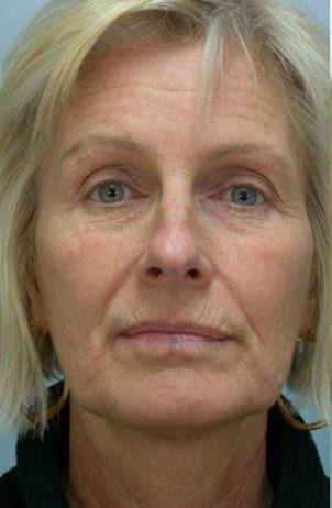 Close-up portrait of an older woman with blonde hair and blue eyes, wearing small earrings and a black shirt, looking directly at the camera.