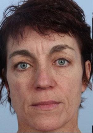 A close-up portrait of a woman with short brown hair and striking blue eyes, showing a neutral expression against a light background.