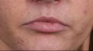 Close-up image of a person's lips, showing natural skin texture with a small mole on the left side. lips appear closed and slightly moist.