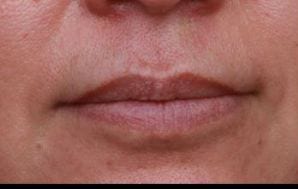 Close-up of a person's mouth and lower face, showing lips and chin, with no distinguishing or unique features, focus on skin texture and lip details.