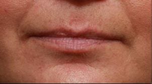 Close-up image of a person's lips, showing detailed skin texture and natural lip color, framed tightly to focus solely on the mouth area.