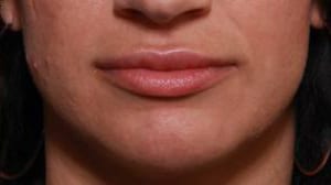 Close-up of a person's lower face, showing lips and chin with subtle smile, against a neutral background.