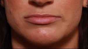 Close-up image of the lower half of a person's face, featuring the nose, mouth, and chin, showing detailed skin texture and natural lips.