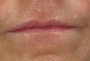 Close-up of a person's closed lips, showing details of the skin texture and natural lip color. no expression is discernible from the image.