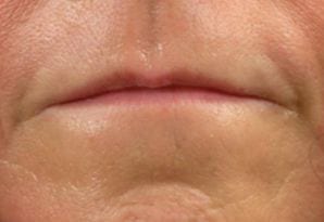Close-up of a person's closed mouth and the lower part of the nose, showing detailed skin texture and subtle facial lines.