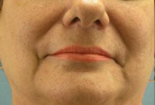 Close-up of the lower half of a woman's face, showing nose, mouth, and chin against a blue background, highlighting a subtle smile.