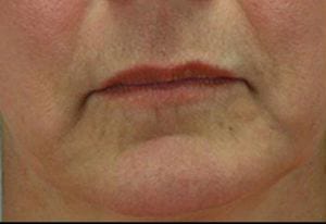 Close-up image of the lower half of a person's face, showing the mouth and chin area with a focus on details like lips, skin texture, and subtle facial hair.