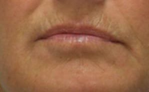 Close-up of a person's lips set in a neutral expression, showing detailed skin texture and a slight frown.