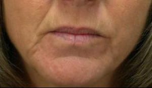 Close-up of the lower half of a woman's face, showing her closed lips, chin, and part of her cheeks. her skin is fair with some visible aging signs like lines and slight sagging.