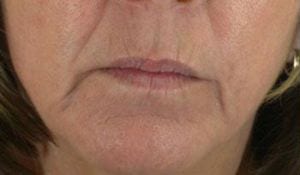 Close-up of the lower half of a woman's face, showing her nose down to her chin, focusing on her lips and skin texture.