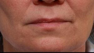 Close-up of a person's lower face, showing lips pressed together and a part of their cheeks, focusing on the mouth and chin area. the background is indistinct.