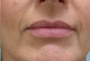 Close-up of a person's mouth showing lips slightly parted, with a neutral expression. the skin texture and lip color appear natural.