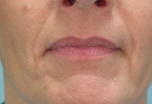 Close-up of the lower half of a person's face, showing a closed mouth with lightly pursed lips, and a slightly dimpled chin. the background is a pale blue.