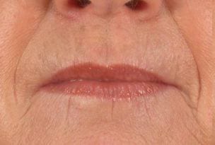 Close-up of a person's lips showing fine lines and subtle shine on the lip surface, with part of the surrounding skin visible.