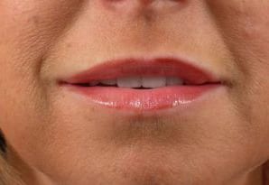 Close-up of a person's mouth showing a slightly smiling expression, with detailed view of lips lightly coated with gloss and visible skin texture.