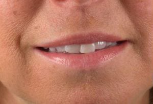 Close-up of a person's smile, showing slightly parted lips and white teeth, with detailed texture of the skin around the mouth visible.