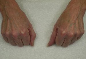 Close-up of an elderly person's hands with noticeable veins and aging skin, resting on a white surface.