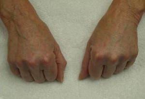Two aged hands resting on a light grey surface, positioned with fists gently clenched, showing details like veins and wrinkles.