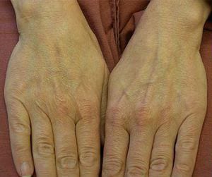 Two open human hands with visible lines and wrinkles, palms facing up against a blurry reddish-brown background.