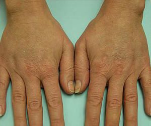 Two hands with fingers slightly spread apart, resting palms down on a light turquoise surface.