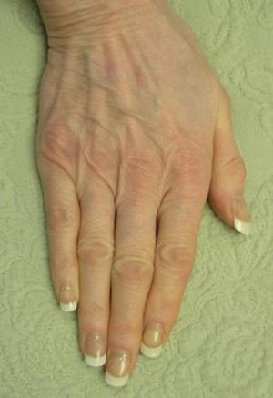 Close-up of an open human hand resting against a textured pale green surface, displaying the palm and slightly curled fingers with natural, well-maintained nails.