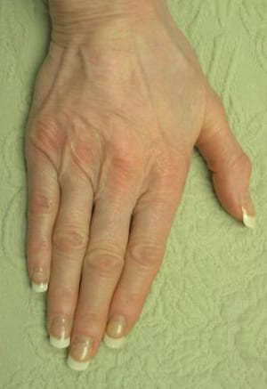 A close-up of a human hand with well-manicured nails resting on a textured green background. the hand appears relaxed, displaying natural skin tones and visible veins.