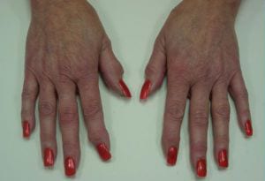 Two hands with red-painted fingernails are placed against a white background, palms down and fingers slightly spread.