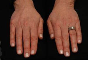 Two hands with fingers slightly spread, resting against a black background. the left hand displays a ring with a stone, visible on the ring finger.