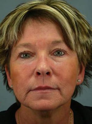 Portrait of a middle-aged woman with short brown hair, wearing small earrings, and looking directly at the camera with a neutral expression.