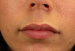 Close-up of a person's lower face showing the nose and lips, with a focus on the skin texture and lip shape. the person has a smooth complexion and natural-colored lips.