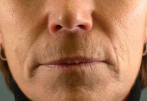 Close-up of a person's lower face, showing nose, mouth, and chin, against a grey background. visible details include skin texture and subtle facial expressions.