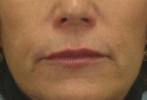 Close-up of the lower half of a woman's face, showing her lips, chin, and the base of her nose, without revealing her full identity.