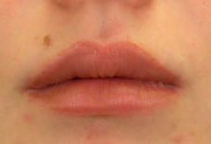 Close-up of a person's lips showing slight dryness and a small mole above the left side of their upper lip. the lips are gently closed.