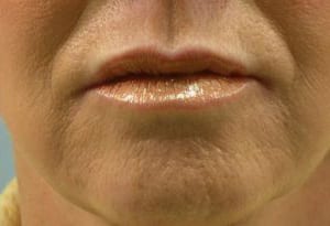 Close-up of a person's mouth showing lips and chin against a yellow background. the lips are slightly parted, and the skin exhibits some stubble.